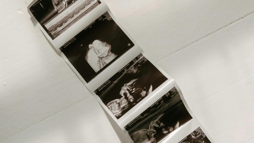 male-pregnancy-canva